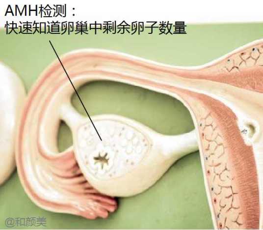 抗缪勒管激素