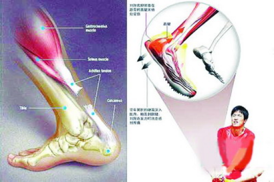 什么是运动医学（医学与体育运动相结合的综合性应用科学）