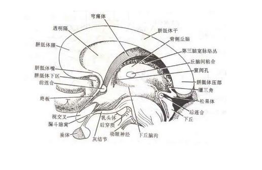 垂体胶样囊肿