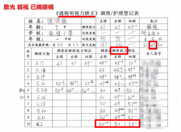 弱视治疗方法