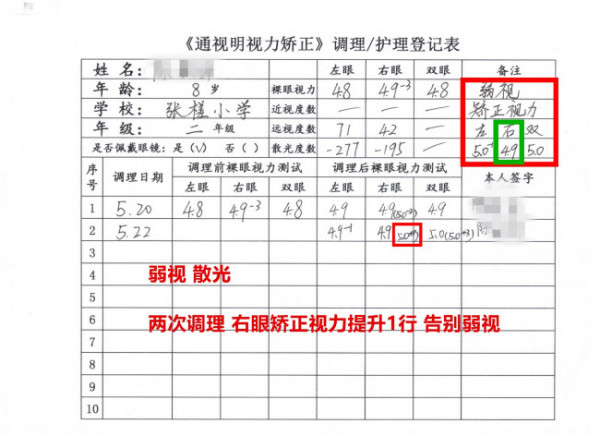 弱视治疗方法