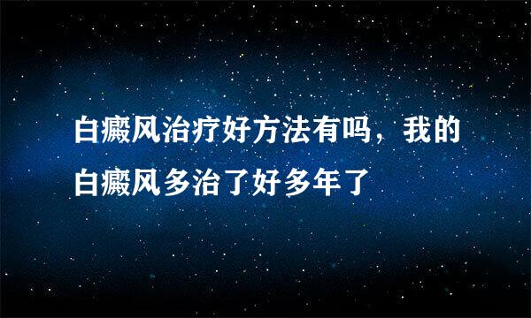 白癜风治疗好方法有吗，我的白癜风多治了好多年了