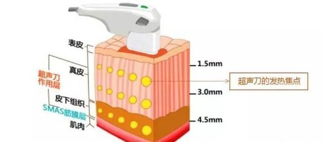 超声波美容仪的工作原理及功能是什么