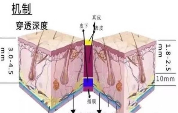 超声波美容仪的工作原理及功能是什么