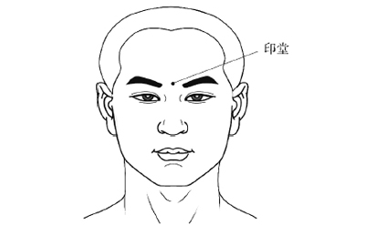 同事说我印堂发黑怎么办？