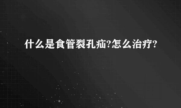 什么是食管裂孔疝?怎么治疗?