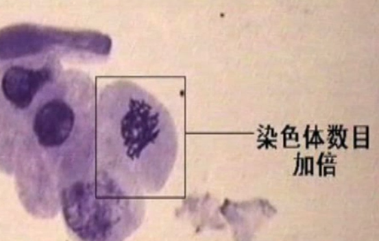 低温诱导植物染色体数目变化的实验怎么做