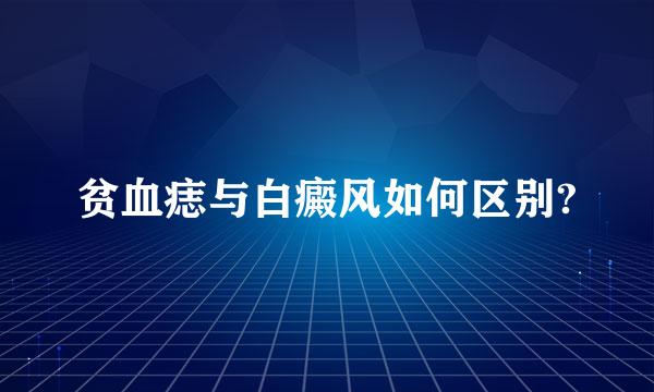 贫血痣与白癜风如何区别?