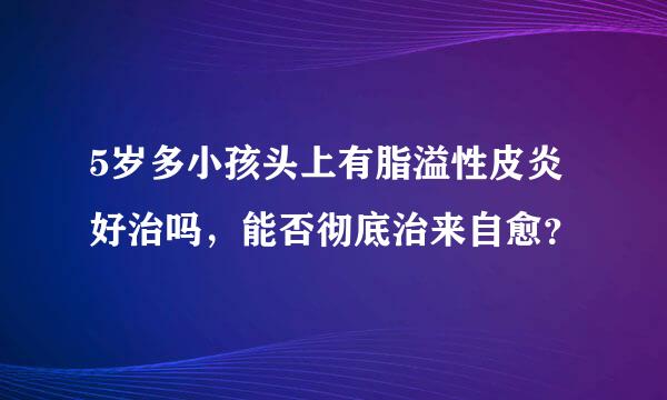 5岁多小孩头上有脂溢性皮炎好治吗，能否彻底治来自愈？