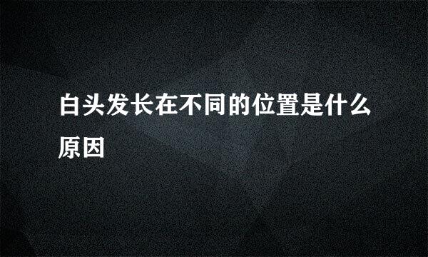 白头发长在不同的位置是什么原因