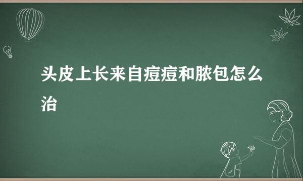 头皮上长来自痘痘和脓包怎么治