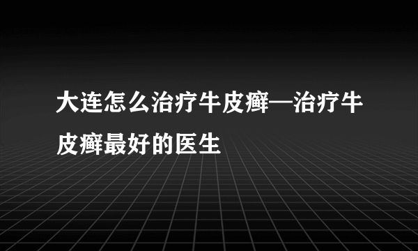 大连怎么治疗牛皮癣—治疗牛皮癣最好的医生