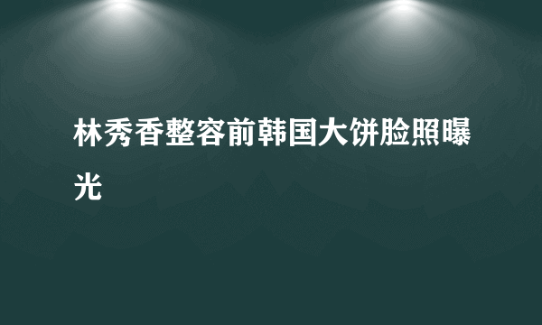 林秀香整容前韩国大饼脸照曝光