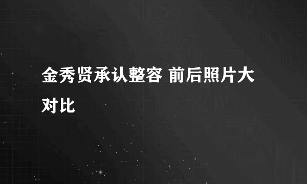 金秀贤承认整容 前后照片大对比