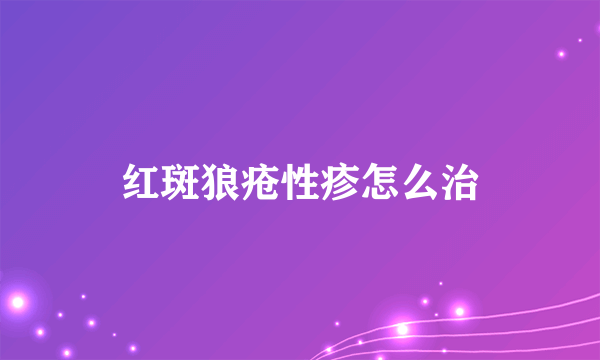 红斑狼疮性疹怎么治