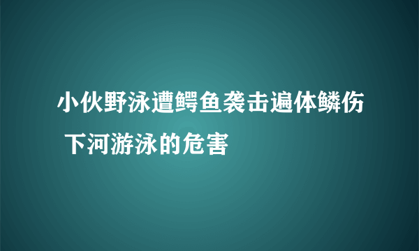 小伙野泳遭鳄鱼袭击遍体鳞伤 下河游泳的危害