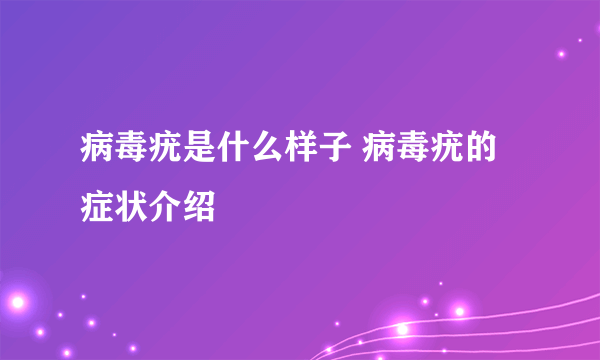 病毒疣是什么样子 病毒疣的症状介绍