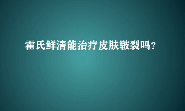 霍氏鲜清能治疗皮肤皲裂吗？