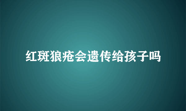 红斑狼疮会遗传给孩子吗