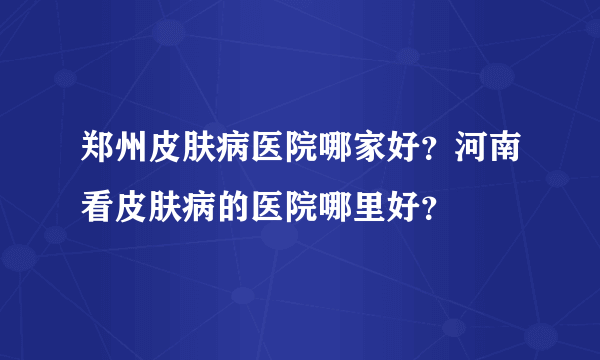 郑州皮肤病医院哪家好？河南看皮肤病的医院哪里好？  