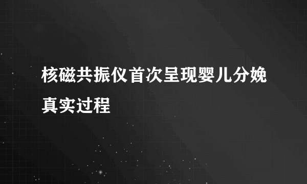 核磁共振仪首次呈现婴儿分娩真实过程