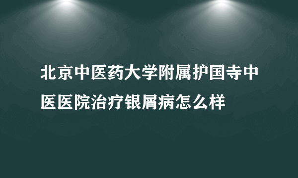 北京中医药大学附属护国寺中医医院治疗银屑病怎么样