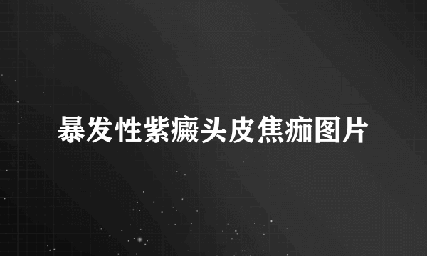 暴发性紫癜头皮焦痂图片