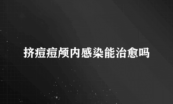 挤痘痘颅内感染能治愈吗