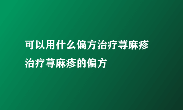 可以用什么偏方治疗荨麻疹  治疗荨麻疹的偏方