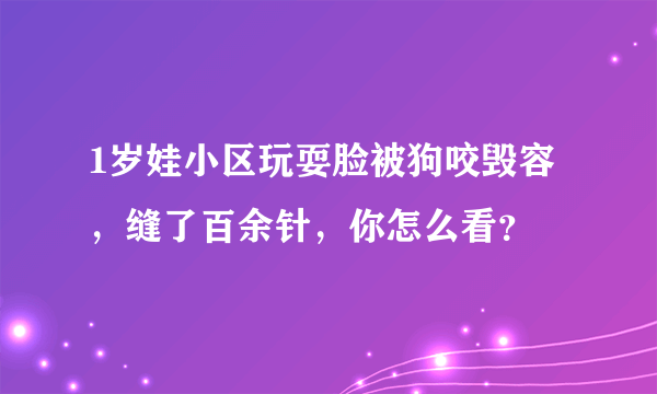 1岁娃小区玩耍脸被狗咬毁容，缝了百余针，你怎么看？